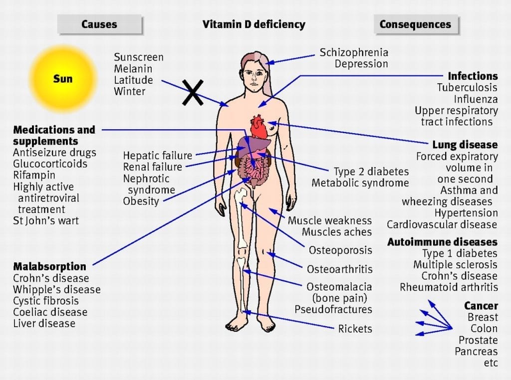 Vitamin D Injections In Phoenix AZ Suddenly Slimmer Med Spa vitamin-d-injections-in-phoenix-az-suddenly-slimmer-med-spa