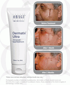 Dermatix Ultra