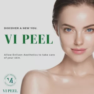 vi-peel-4