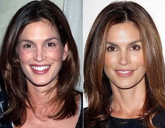 Cindy Crawford - Celebrity Botox & Fillers Before and After