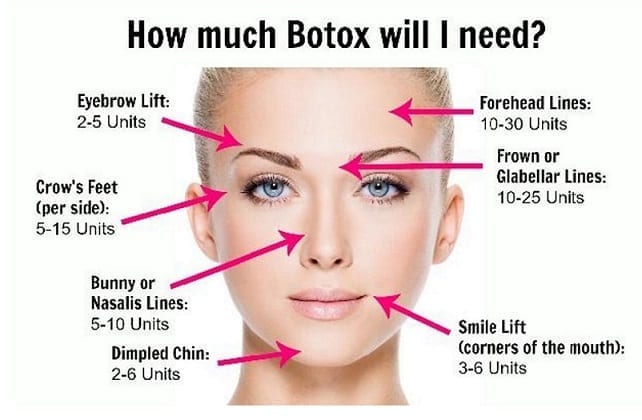 how-many-units-of-botox-will-i-need-phoenix-paradise-valley-scottsdale-arizona