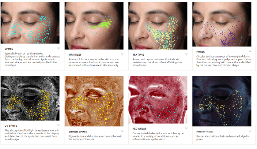 Visia-Complexion-Analysis-Phoenix-Paradise-Valley-Scottsdale-Arizona