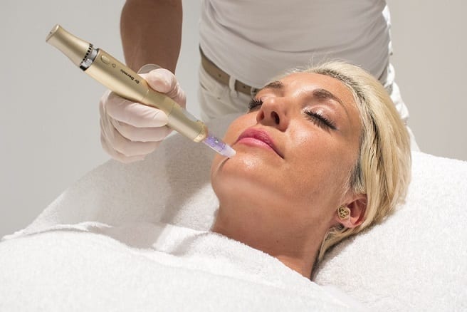 microneedling-stem-cell-phoenix-paradise-valley-scottsdale-arizona