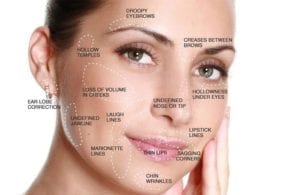 dermal-filler-phoenix-paradise-valley-scottsdale-arizona