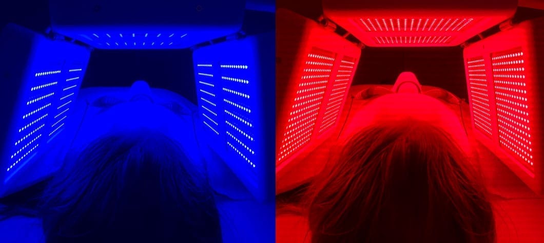 red-light-and-blue-light-acne-treatment-phoenix-scottsdale-paradise-valley-arizona