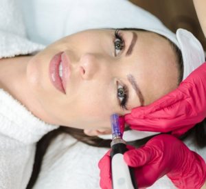 Microneedling-Pre-and-Post -Care-Instructions