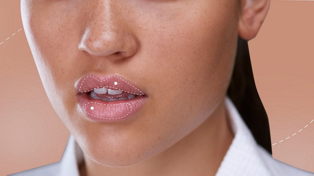 HOW-TO-PREPARE-FOR-LIP-FILLER-HOW-TO-CARE-FOR-YOUR-LIPS-AFTER-LIP-INJECTION