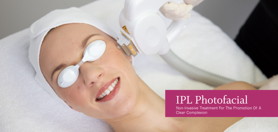 IPL-Photofacial-aftercare