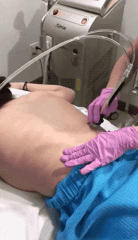 Diamond-Glow-Back-Facial