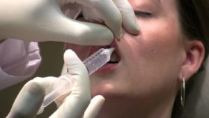 dental-block-numbing-prior-to-lip-filler-phoenix
