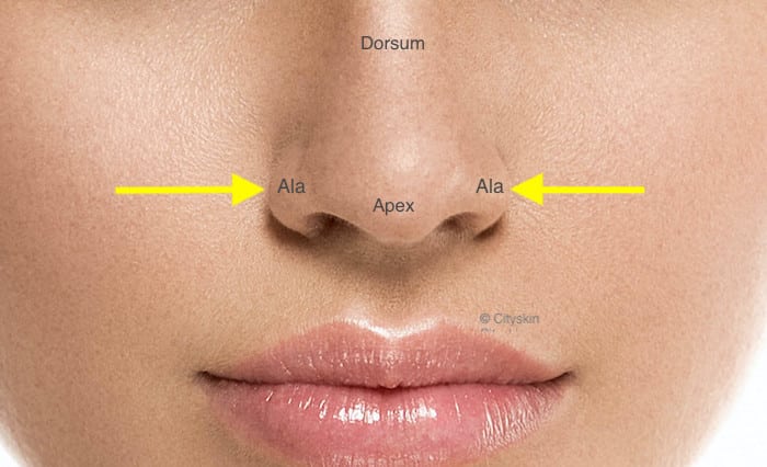 Botox Nose Slimming PHX