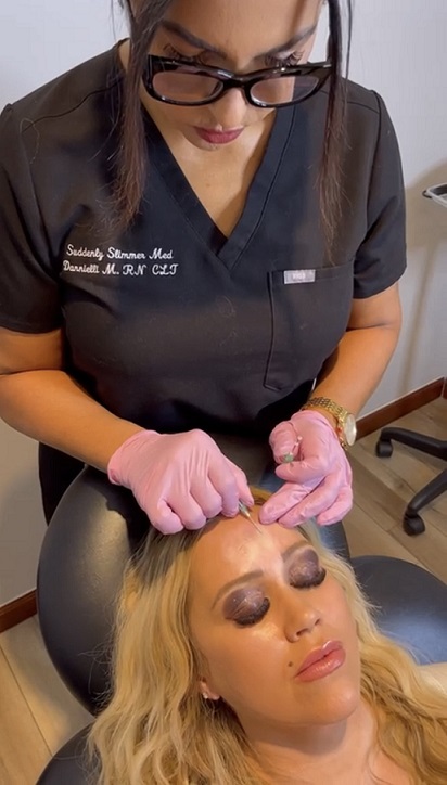 Threading Frown Line Frown Lines PDO Thread Lift | Suddenly Slimmer Med Spa Phoenix