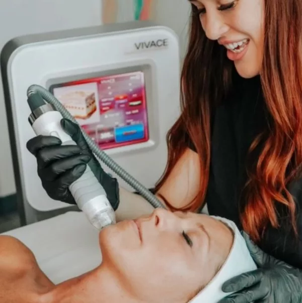 Vivace-RF-MicroNeedling