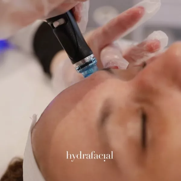 hydrafacial-2