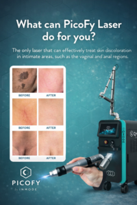 PicoFy-Laser-Skin-Discoloration-anal-vaginal-area-phx